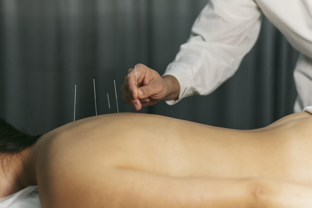 Acupuncturist in wijchen